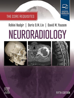 cover image of Neuroradiology